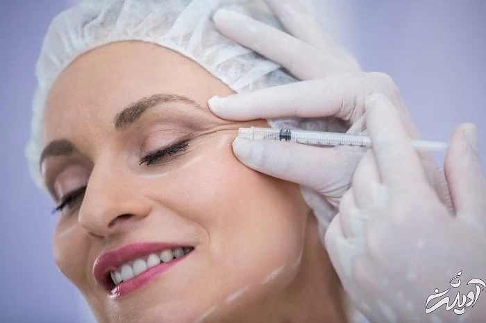 تزریق چربی برای رفع سیاهی دور چشم تزریق چربی